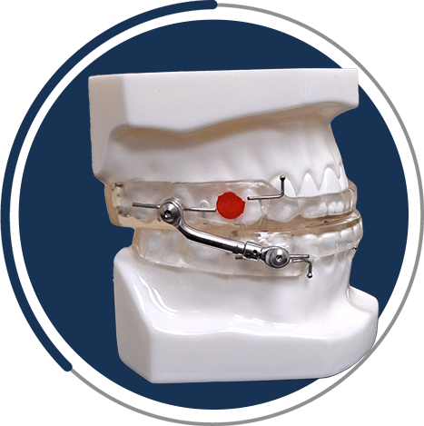 White colored teeth appliance with round blue background